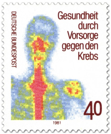Stamp: Szintigramm (Krebs-Vorsorge)